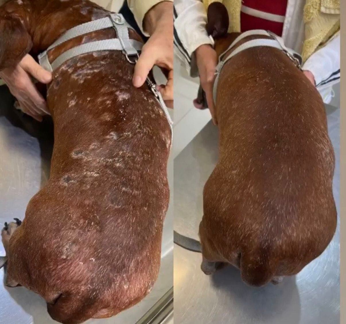 Caso de Pioderma recorrente — undefined, undefined